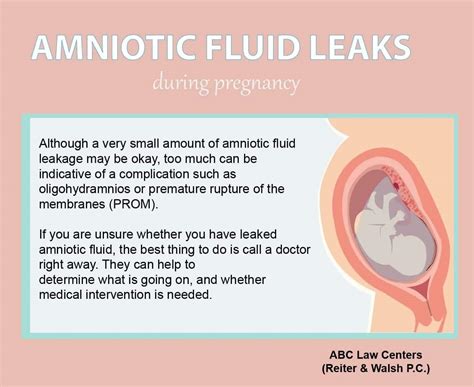 treatment for leaking amniotic fluid|Signs of Leaking Amniotic Fluid vs. Discharge (& What to Do)